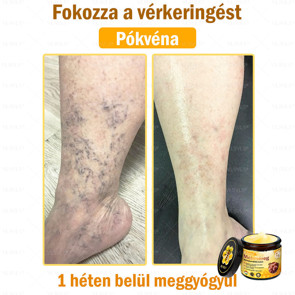 ⭐VLSVLS® Méhméreg Bőrhelyreállító Krém (👨⚕CE jóváhagyott)