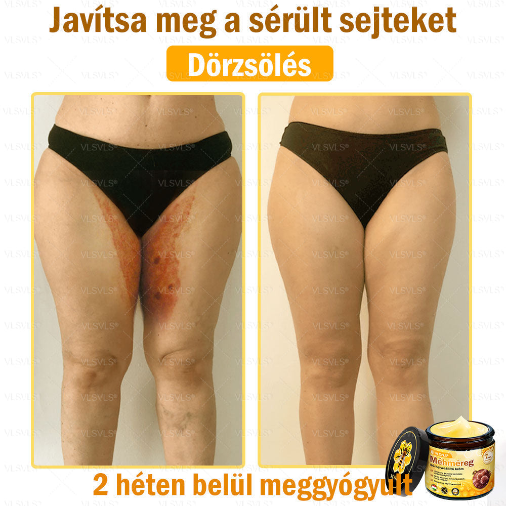 ⭐VLSVLS® Méhméreg Bőrhelyreállító Krém (👨⚕CE jóváhagyott)