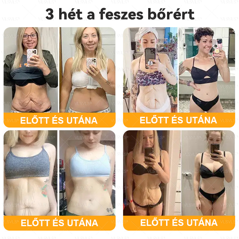 đ VLSVLSÂź MĂ©hmĂ©reg BĆrhelyreĂĄllĂtĂł KrĂ©m đ„ UTOLSĂ NAP â 80% KEDVEZMĂNY