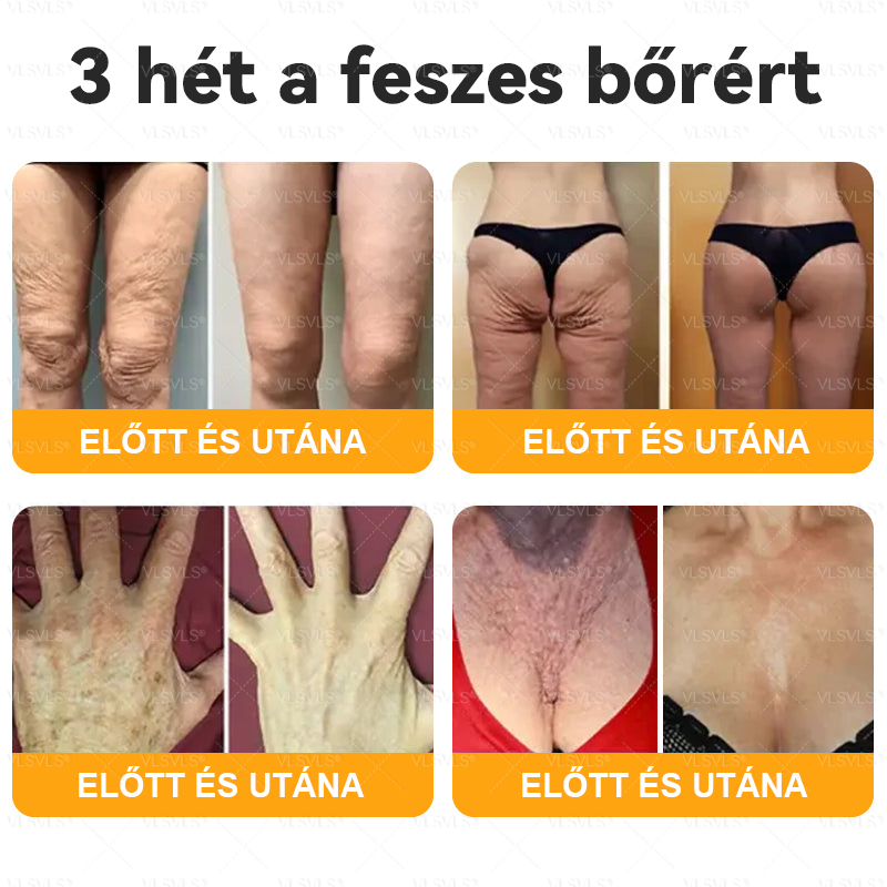 đ VLSVLSÂź MĂ©hmĂ©reg BĆrhelyreĂĄllĂtĂł KrĂ©m đ„ UTOLSĂ NAP â 80% KEDVEZMĂNY