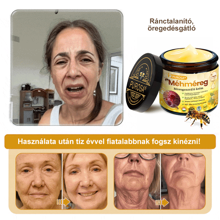 🎁PUROSA® Méhméreg Bőrmegújító Krém🐝|Teljes körű megoldás a makacs bőrproblémák, például az öregedés, ekcéma, hegek és pikkelysömör ellen