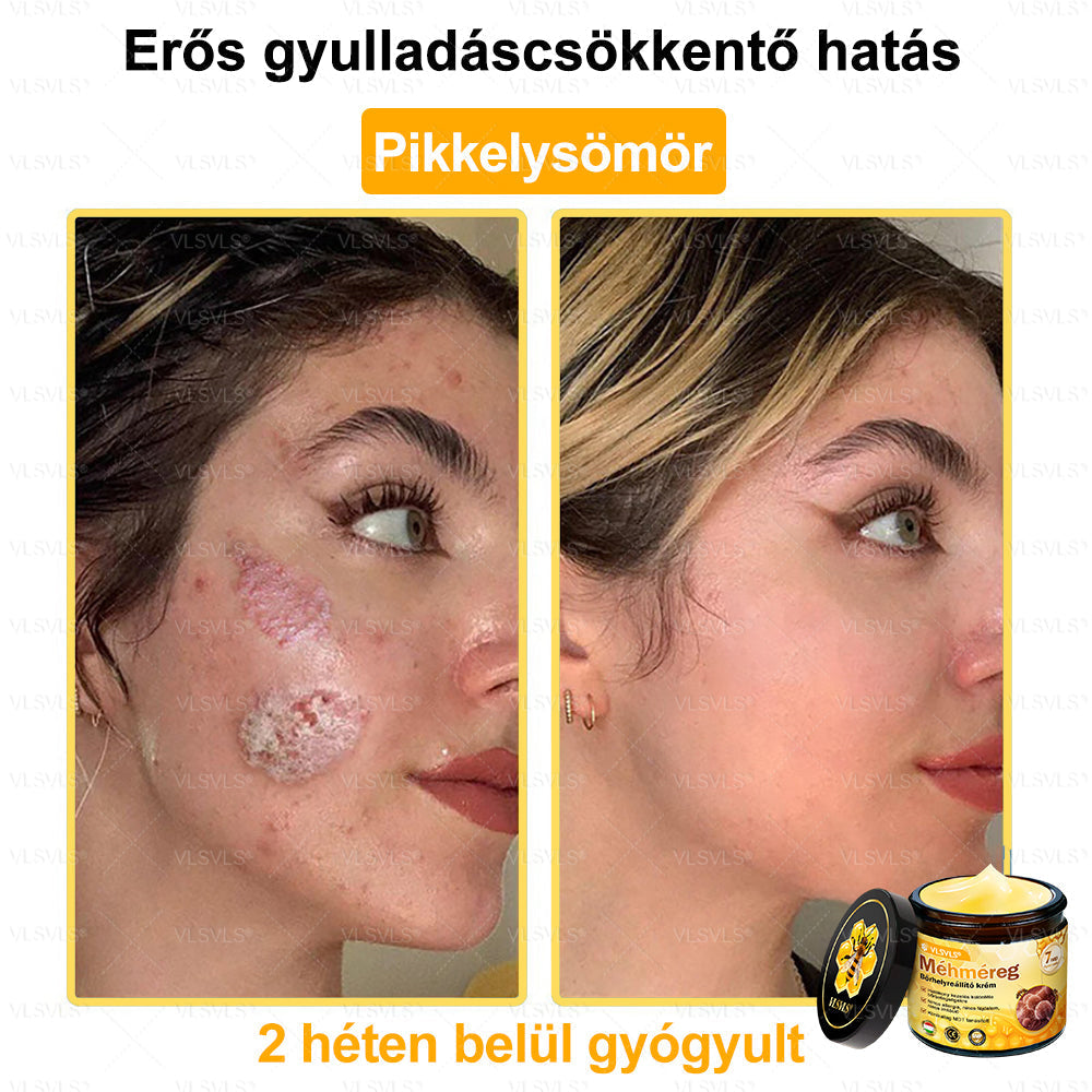 ⭐VLSVLS® Méhméreg Bőrhelyreállító Krém (👨⚕CE jóváhagyott)