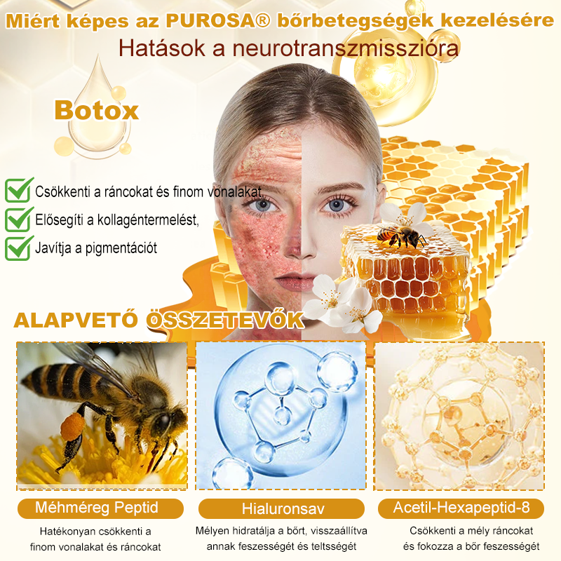 🎁PUROSA® Méhméreg Bőrmegújító Krém🐝|Teljes körű megoldás a makacs bőrproblémák, például az öregedés, ekcéma, hegek és pikkelysömör ellen