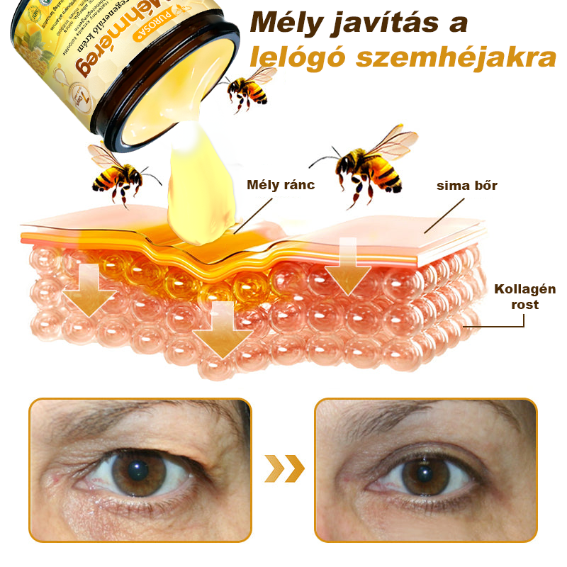 🎁PUROSA® Méhméreg Bőrmegújító Krém🐝|Teljes körű megoldás a makacs bőrproblémák, például az öregedés, ekcéma, hegek és pikkelysömör ellen