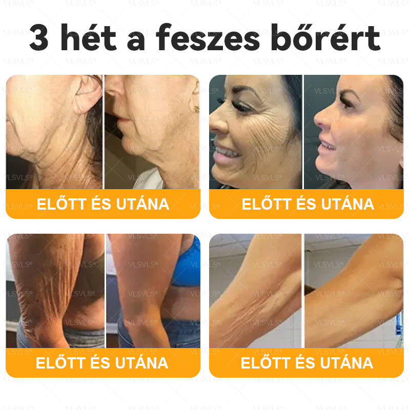 đ VLSVLSÂź MĂ©hmĂ©reg BĆrhelyreĂĄllĂtĂł KrĂ©m đ„ UTOLSĂ NAP â 80% KEDVEZMĂNY