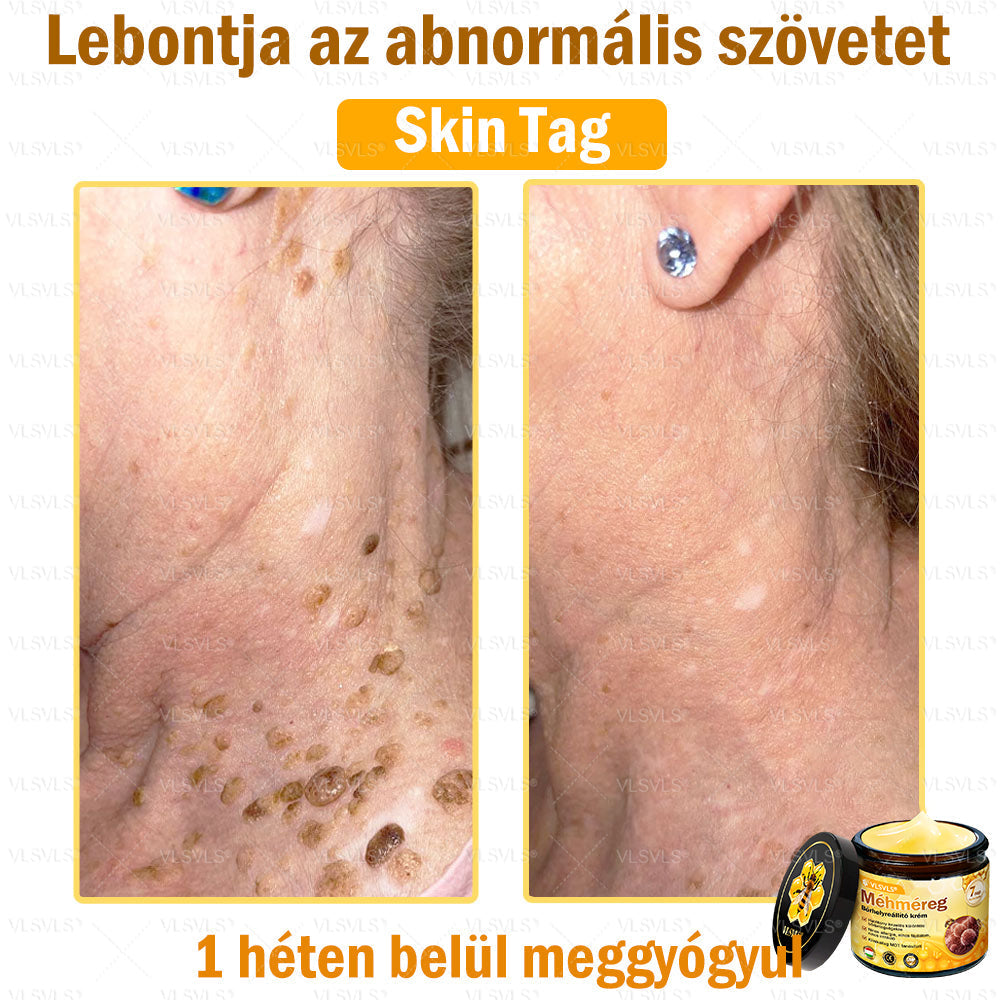 ⭐VLSVLS® Méhméreg Bőrhelyreállító Krém (👨⚕CE jóváhagyott)