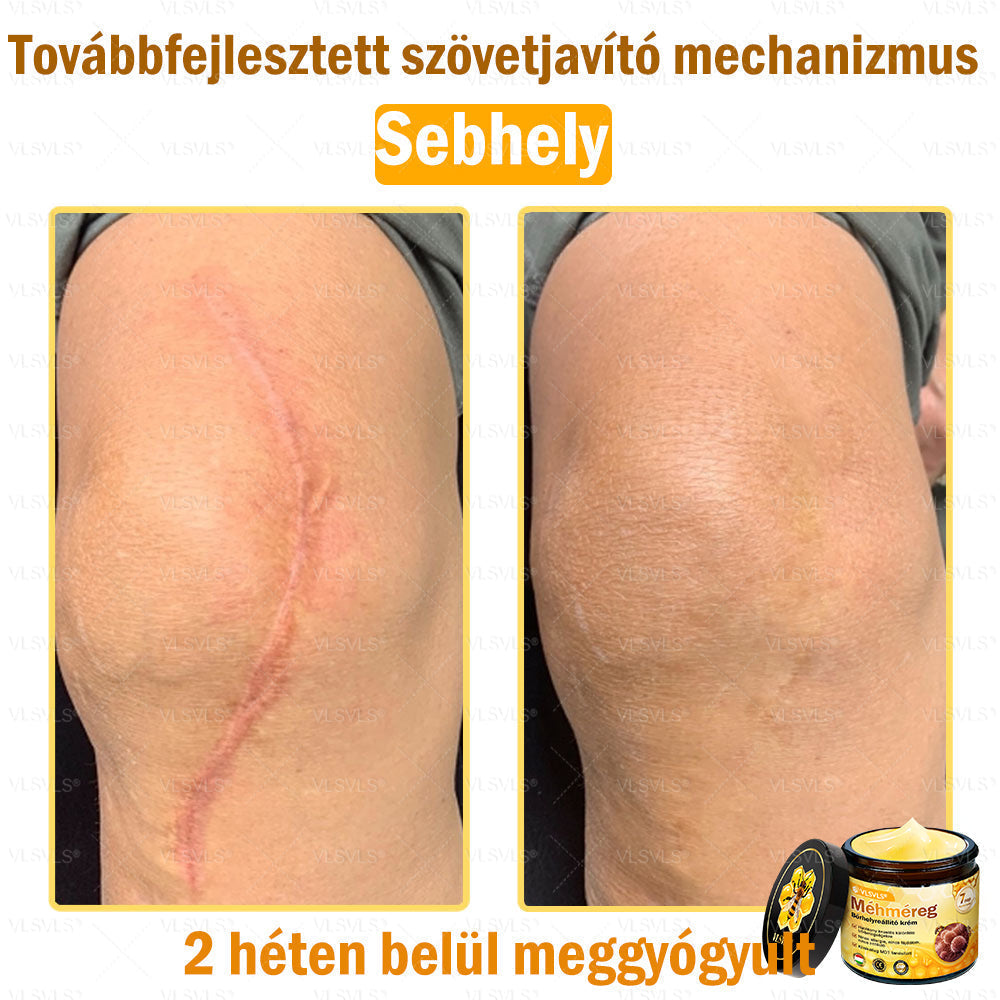⭐VLSVLS® Méhméreg Bőrhelyreállító Krém (👨⚕CE jóváhagyott)