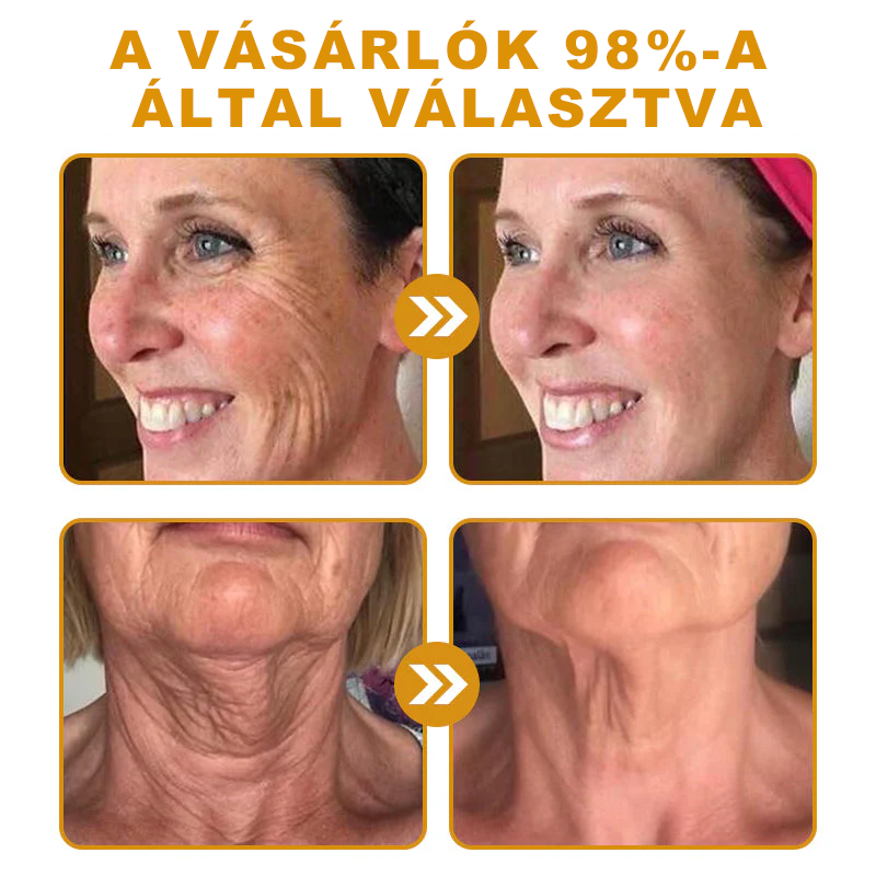 🎁PUROSA® Méhméreg Bőrmegújító Krém🐝|Teljes körű megoldás a makacs bőrproblémák, például az öregedés, ekcéma, hegek és pikkelysömör ellen
