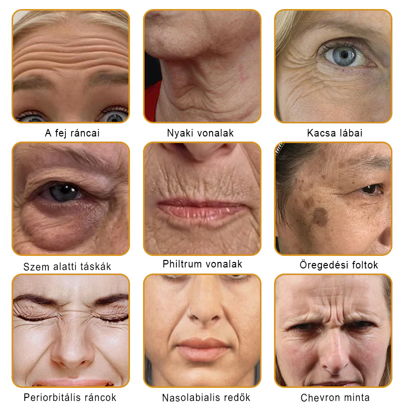 🎁PUROSA® Méhméreg Bőrmegújító Krém🐝|Teljes körű megoldás a makacs bőrproblémák, például az öregedés, ekcéma, hegek és pikkelysömör ellen