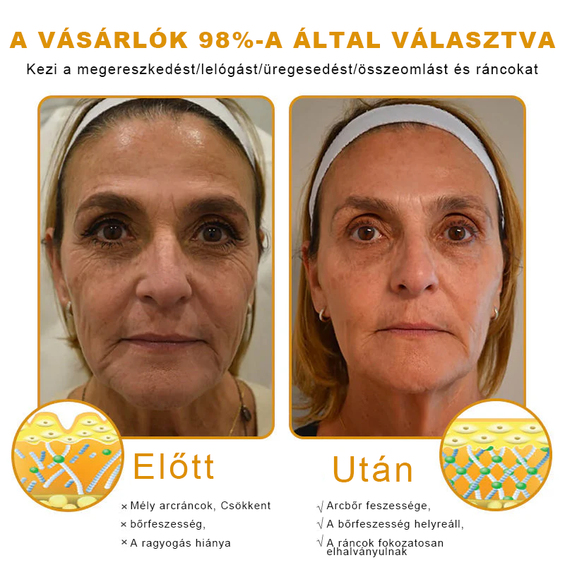 🎁PUROSA® Méhméreg Bőrmegújító Krém🐝|Teljes körű megoldás a makacs bőrproblémák, például az öregedés, ekcéma, hegek és pikkelysömör ellen
