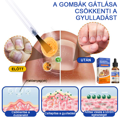 🐝Furzero™ Méhméreg Körömgomba Kezelőoldat: Teljes megoldás a körömgomba problémájára💎