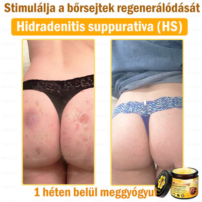 ⭐VLSVLS® Méhméreg Bőrhelyreállító Krém (👨‍⚕‍CE jóváhagyott)
