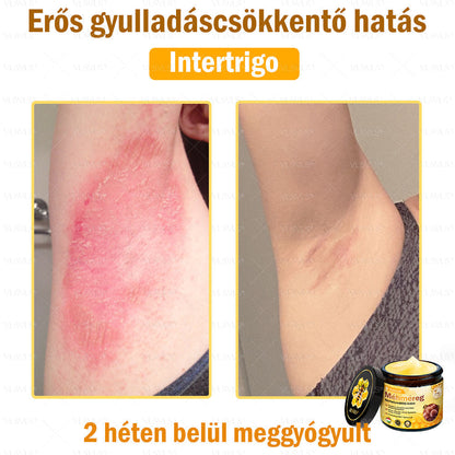 ⭐VLSVLS® Méhméreg Bőrhelyreállító Krém (👨‍⚕‍CE jóváhagyott)
