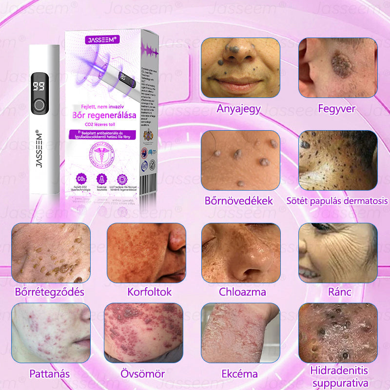 🌟𝐉𝐚𝐬𝐬𝐞𝐞𝐦® Zaawansowany nieinwazyjny laser CO₂ do naprawy skóry 🎉 (Delikatnie usuwa brodawki, znamiona, plamy starcze i narośla skórne – bez bólu, bez zamieszania!)🚀
