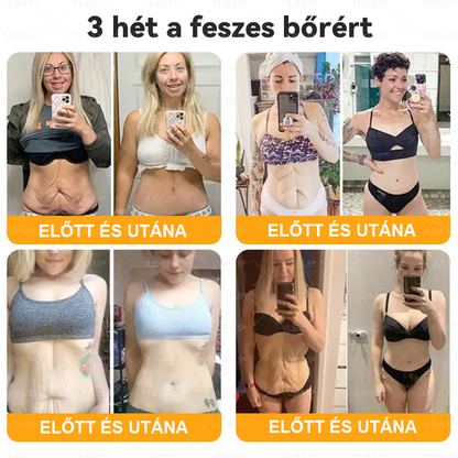 💎 VLSVLS® Méhméreg Bőrhelyreállító Krém 🔥 UTOLSÓ NAP – 80% KEDVEZMÉNY