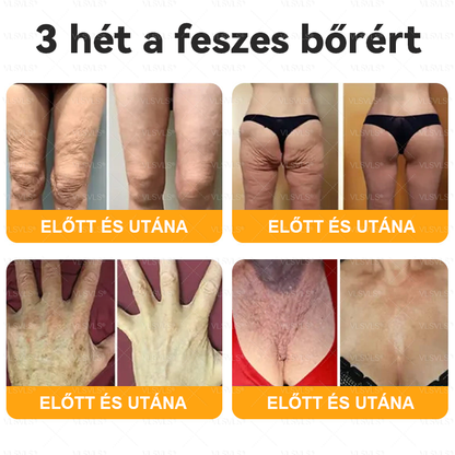 💎 VLSVLS® Méhméreg Bőrhelyreállító Krém 🔥 UTOLSÓ NAP – 80% KEDVEZMÉNY