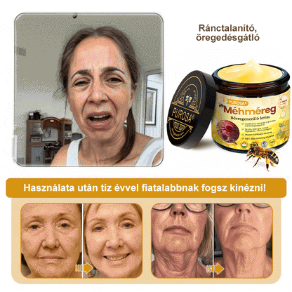 💎PUROSA® Méhméreg Bőrmegújító Krém🐝｜Teljes körű megoldás a makacs bőrproblémák, például az öregedés, ekcéma, hegek és pikkelysömör ellen