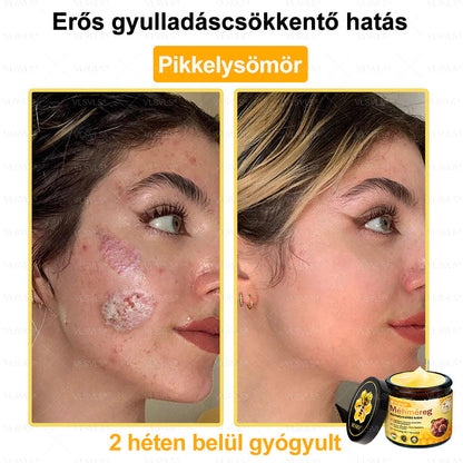 ⭐VLSVLS® Méhméreg Bőrhelyreállító Krém (👨‍⚕‍CE jóváhagyott)