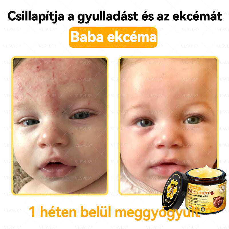 ⭐VLSVLS® Méhméreg Bőrhelyreállító Krém (👨‍⚕‍CE jóváhagyott)