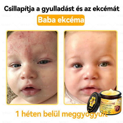 ⭐VLSVLS® Méhméreg Bőrhelyreállító Krém (👨‍⚕‍CE jóváhagyott)