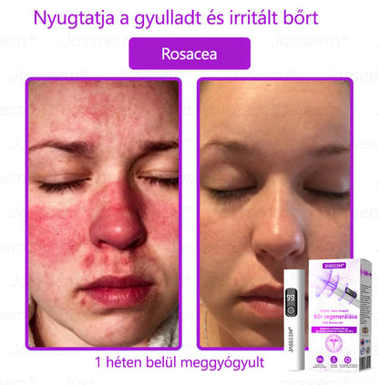 🌟𝐉𝐚𝐬𝐬𝐞𝐞𝐦® Zaawansowany nieinwazyjny laser CO₂ do naprawy skóry 🎉 (Delikatnie usuwa brodawki, znamiona, plamy starcze i narośla skórne – bez bólu, bez zamieszania!)🚀
