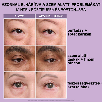 💎Azonnali Szemkörnyék-feszesítő, könnyen viselhető formula🌸 – tökéletes emelés és sima felület ✨