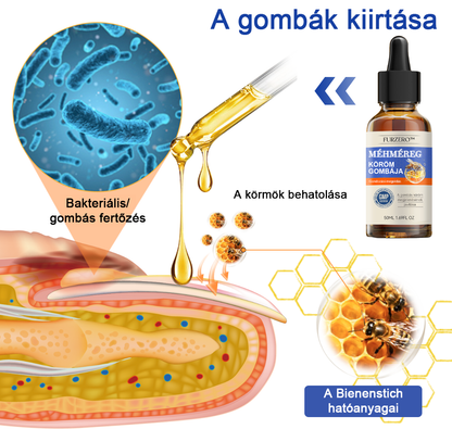 🐝Furzero™ Méhméreg Körömgomba Kezelőoldat: Teljes megoldás a körömgomba problémájára💎